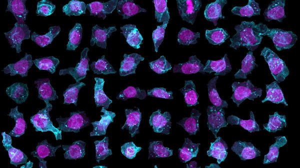 AI Builds Detailed 3D Cell Models to Aid Disease Research